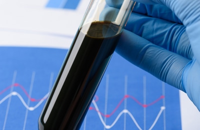 Used Oil Analysis Test Tube